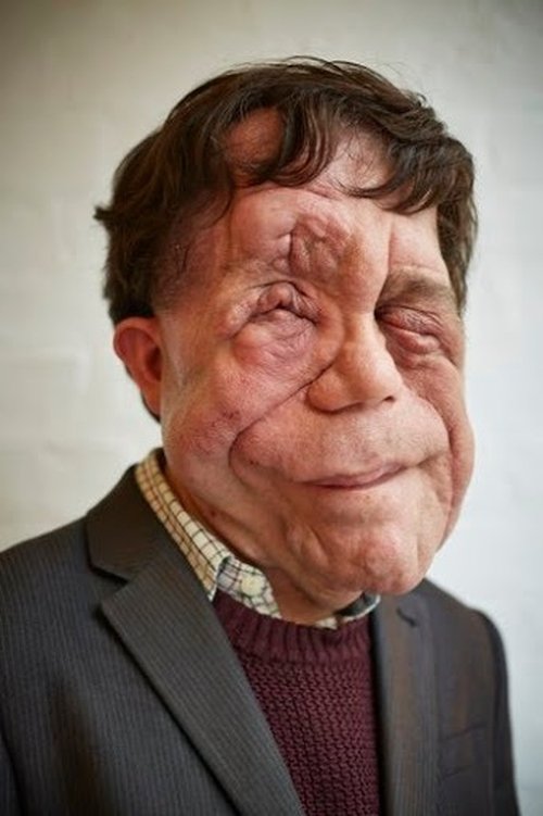 Porträt von Adam Pearson