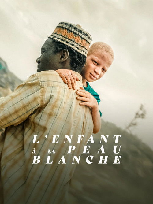 L’Enfant à la Peau Blanche