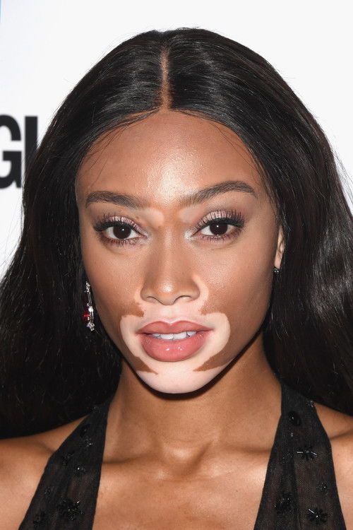 Porträt von Winnie Harlow